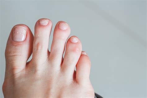 What Does It Mean When You Paint Your Toenails White: A Journey Through Symbolism, Culture, and Personal Expression